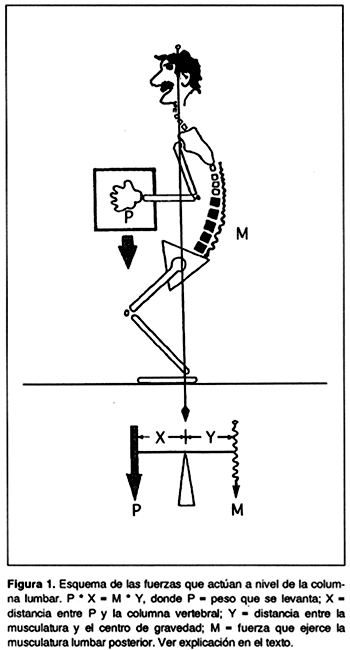 Lumbalgia