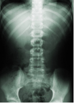 Radiografía de la Columna Vertebral